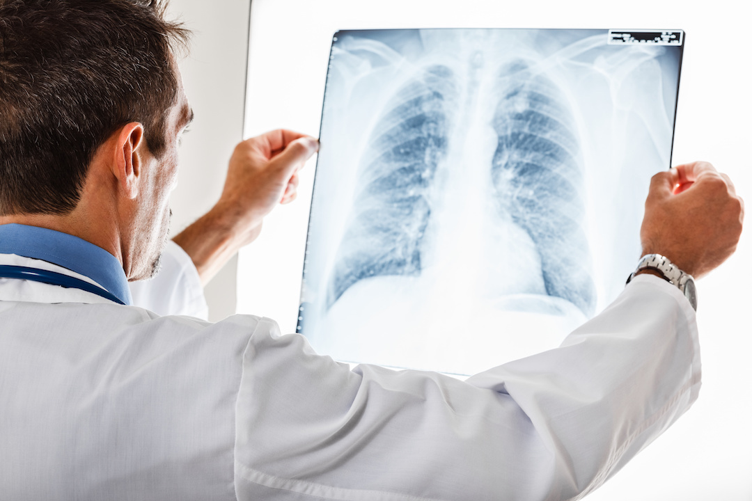 CHEST X-RAY INTERPRETATION